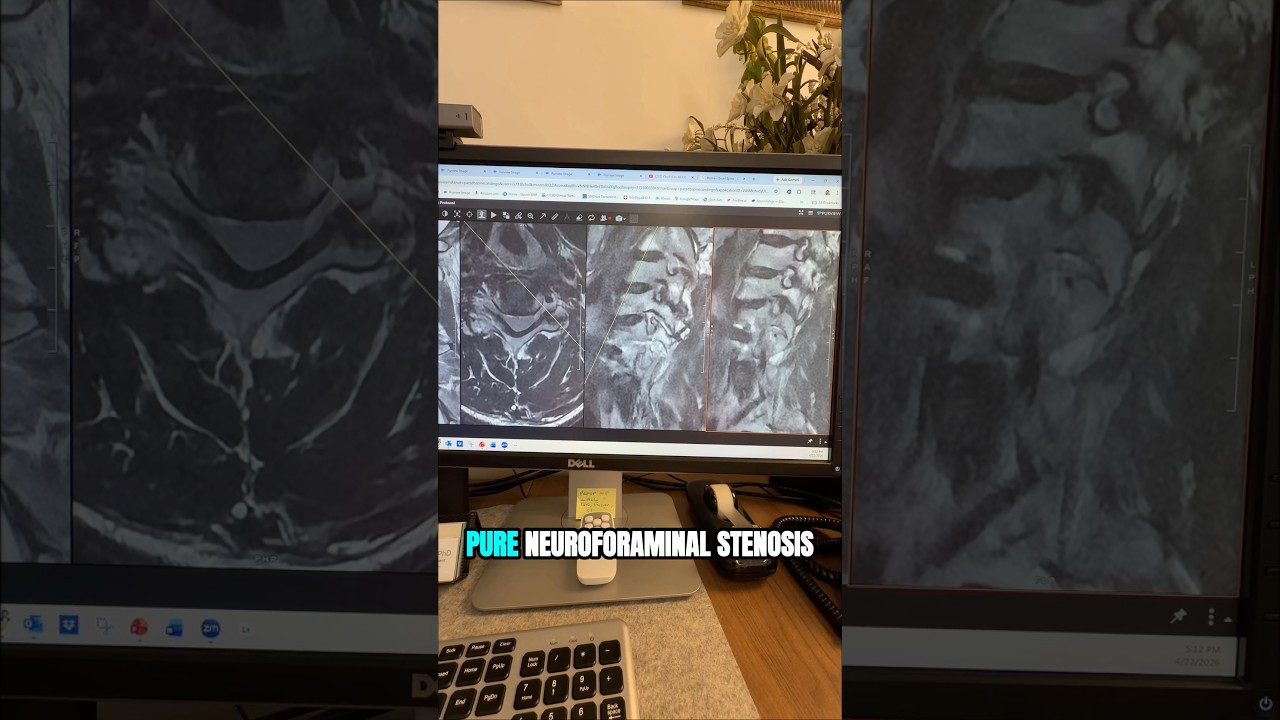 C-Spine Oblique MRI