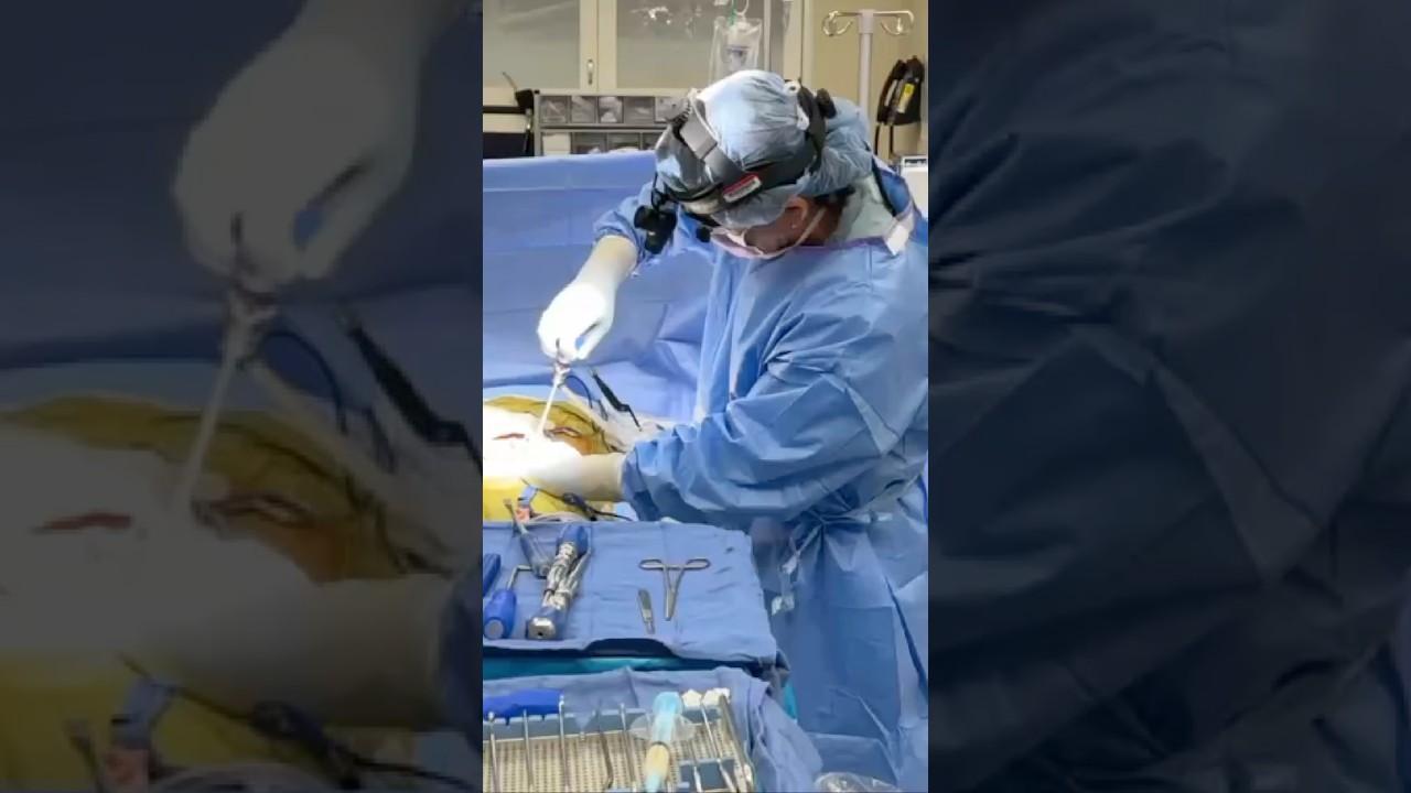 Excel Spine Playlist