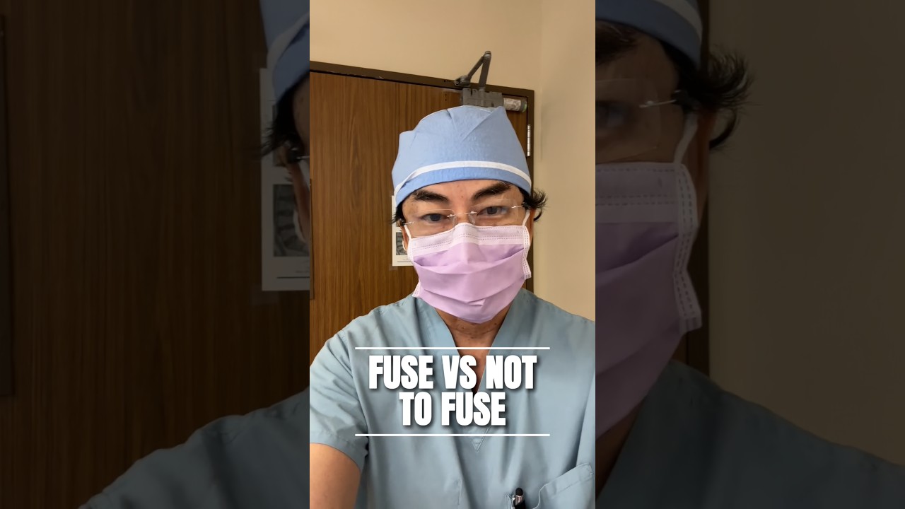 Fixing the Triple Whammy: Revision Fusion for Adjacent Level Degeneration