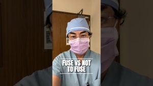 Fixing the Triple Whammy: Revision Fusion for Adjacent Level Degeneration